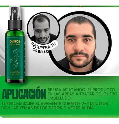 TONICO CAPILAR OUHOE Dile adiós a la caída y la resequedad